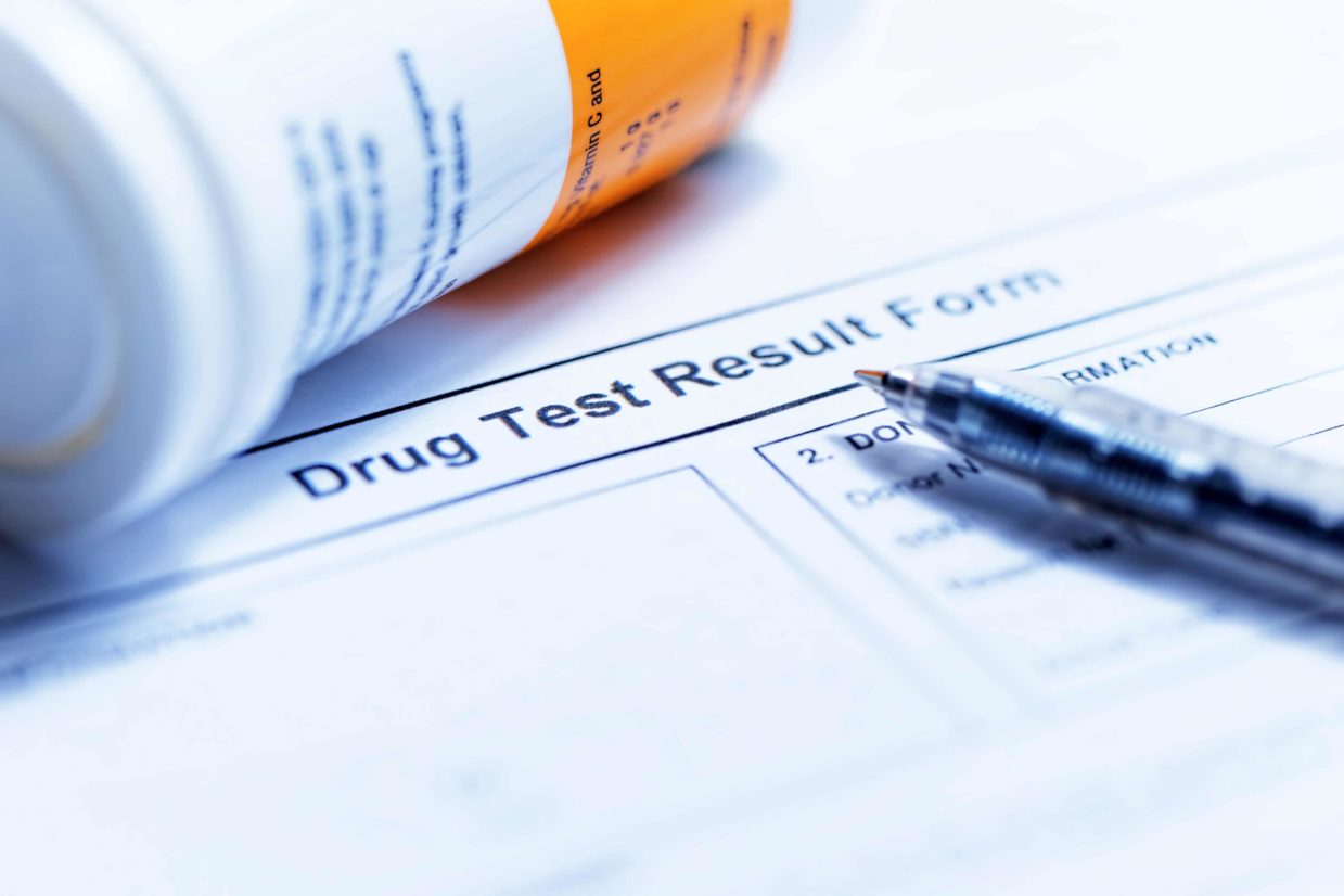 What You Should Know About Medical Cannabis and Drug Testing